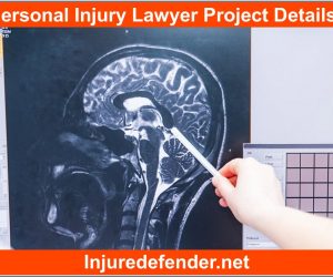 Most Typical Automobile Accident Injuries